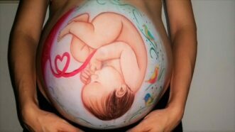 babybauch